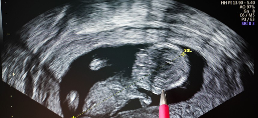 Women seeking abortions in Pennsylvania may be offered ultrasounds of the fetus, as shown above.