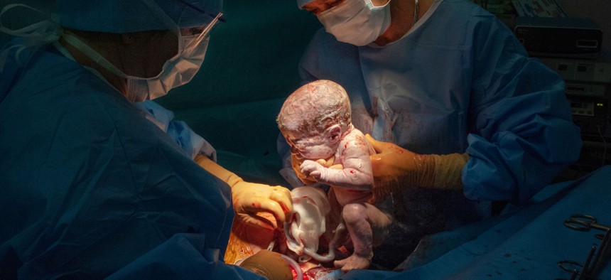 A cesarean section delivery. 