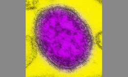 Transmission electron micrograph of a single virus particle, or virion, of measles virus