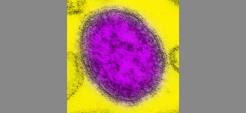Transmission electron micrograph of a single virus particle, or virion, of measles virus